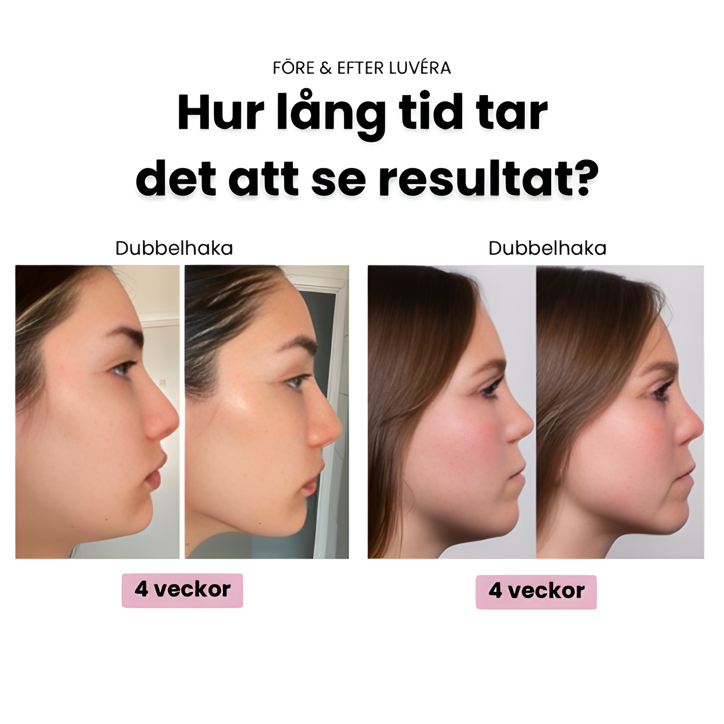 Luvéra - Skulptera din käklinje på bara minuter